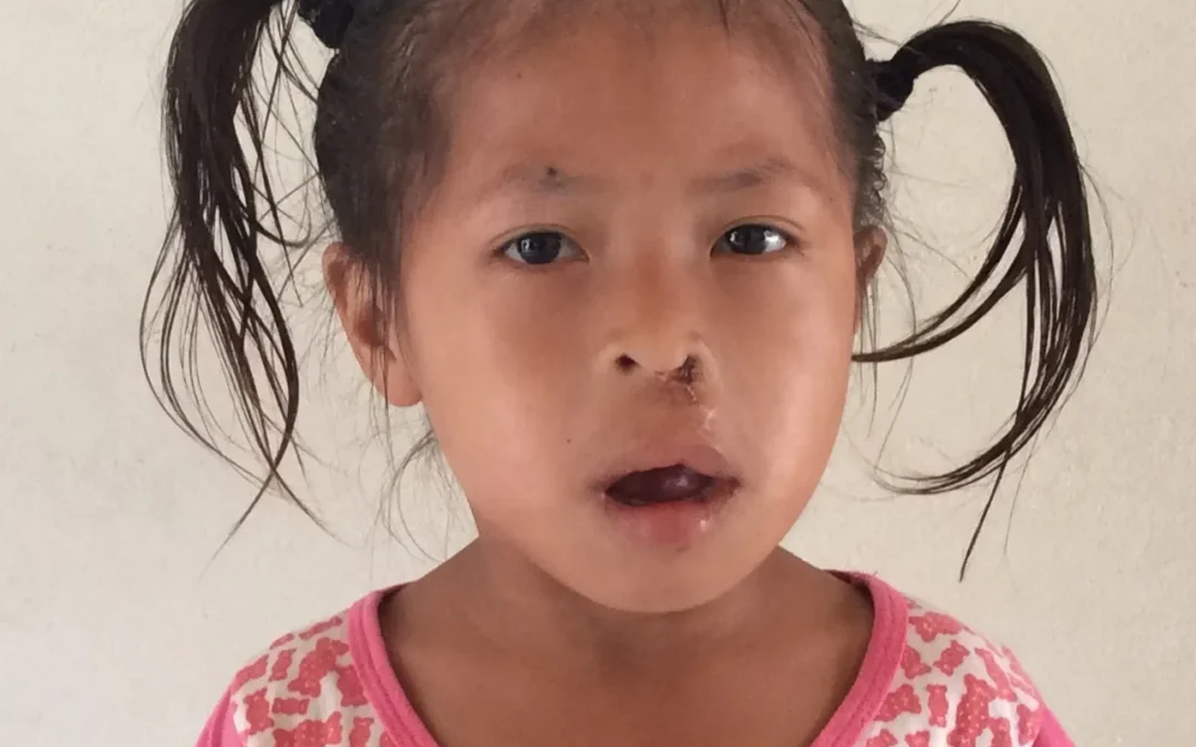 Children receive surgery and medical tests in Georgetown in 2020